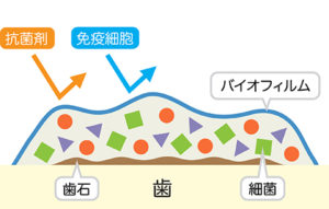 バイオフィルム