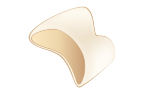 セラミッククラウン