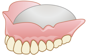 金属床の入れ歯