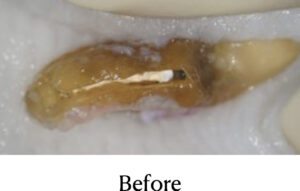 感染物質除去後