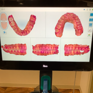 タッチパネルでお口の中をご説明