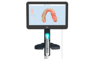 口腔内３Dスキャナー(iTero)撮影