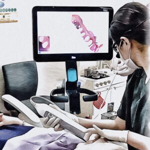 口腔内スキャナーiTero