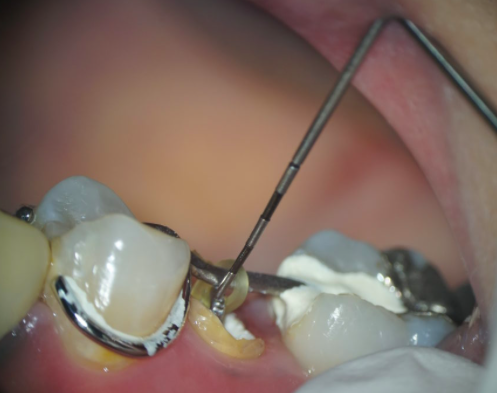 初台の歯医者-ハニー歯科は駅徒歩5分の歯科