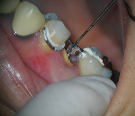 初台の歯医者-ハニー歯科は駅徒歩5分の歯科