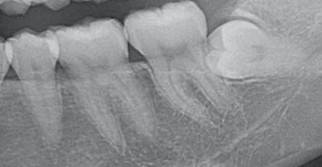 初台の歯医者-ハニー歯科は駅徒歩5分の歯科