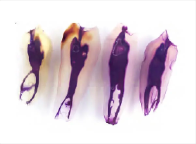 初台の歯医者-ハニー歯科は駅徒歩5分の歯科