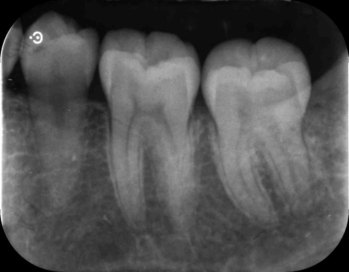 初台の歯医者-ハニー歯科は駅徒歩5分の歯科