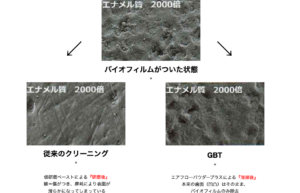 従来のクリーニングとGBTの比較