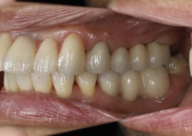 初台の歯医者-ハニー歯科は駅徒歩5分の歯科